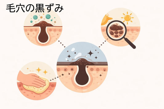 黒ずみの原因と対策方法 | 2026年最新版